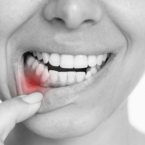 Orasore-Whitening-Toothpaste